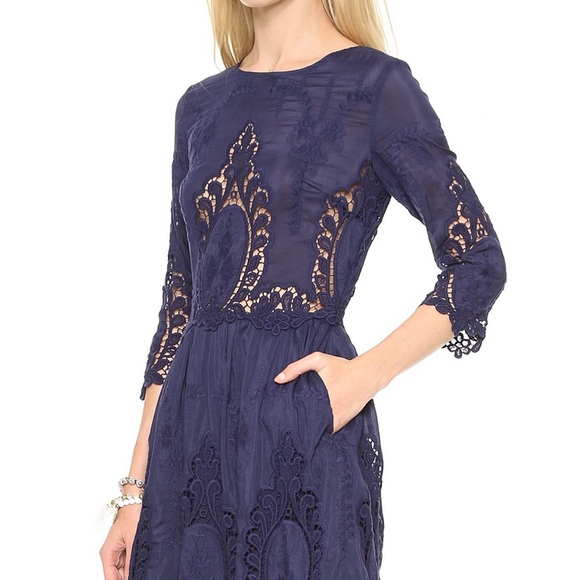 Dolce Vita Blue Silk/Lace Dress - Picture 2 of 10